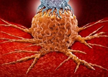 Kolon kanseri nedir? Kalın bağırsak kanseri gençlerde neden artıyor? (5 soruda kolon kanseri)