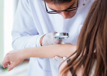 Balık pulu hastalığı neden olur, tedavisi var mı?