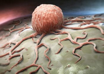 Günde 4,5 dakikayla kanser riskinizi azaltabilirsiniz