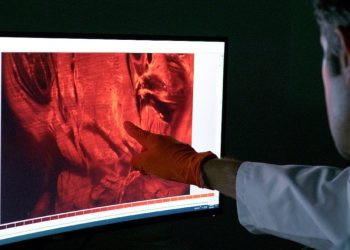 Kanser araştırmalarında yeni dönem: Yapay zekayla şeffaf görüntüleme